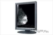 Esposizioni LCD del monitor del grado medico