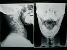 X film di imaging biomedico di Ray