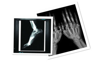 Il film la X Ray medica dell'ANIMALE DOMESTICO di Hosipital di carta impermeabilizza il bianco del film di 8 CT di pollice ×10
