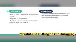 Display medicale HD per imaging diagnostico di precisione