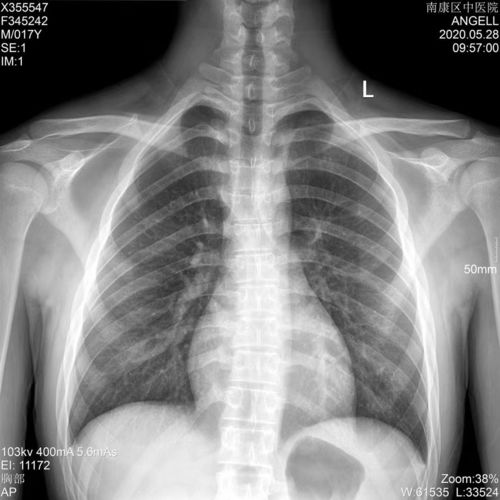 Latest company blogs about Film radiografico medico