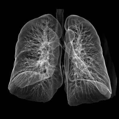 Prezzo buono Laser medico Konida della lastra radioscopica di alta acutezza per il CT/Dott in linea