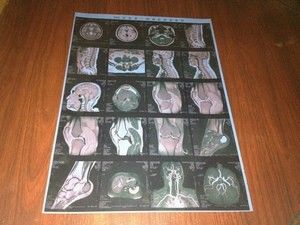 Prezzo buono Lastre radioscopiche mediche della nebbia bassa, film asciutto degli alti di acutezza raggi x di Konida in linea