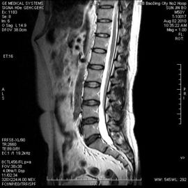 Prezzo buono Film asciutto medico rigido a prova d'umidità 8in x 10in di X Ray per la stampante termica in linea