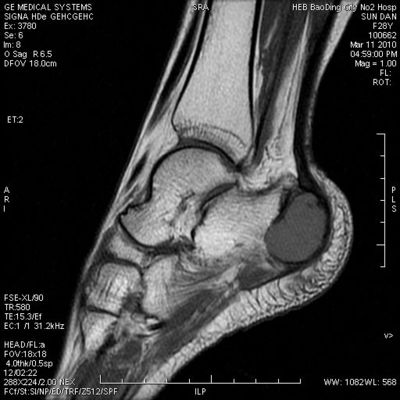 Prezzo buono Film asciutto medico di rappresentazione di alta densità massima di KND-A compatibile con le stampanti termiche in linea