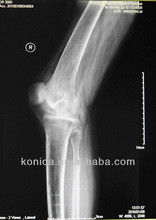 Prezzo buono Rappresentazione diagnostica durevole di X Ray, lastra radioscopica medica del blu del laser della carta di 43cm x di 32cm in linea