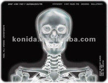 Prezzo buono Film per stampante termica medica a raggi X KND-F25*30cm in linea