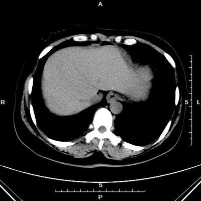 Prezzo buono Carta blu del laser di rappresentazione diagnostica sottile di Konida X Ray per la macchina di raggi x in linea