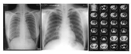 Prezzo buono stampatore termico a 17 pollici Film di 14in X in linea