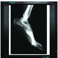 Good price rappresentazione diagnostica medica di 25cm x di 20cm, carta del film X Ray della stampante a laser in linea