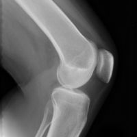 Prezzo buono Alte lastre radioscopiche di acutezza in linea