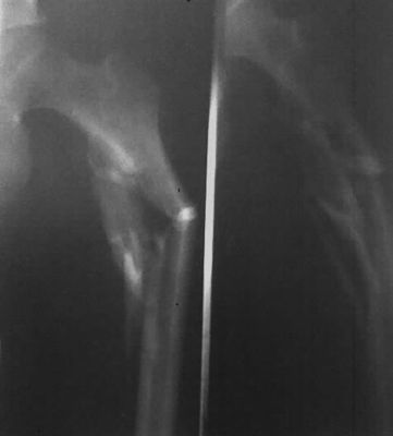 Prezzo buono Film medico della stampante termica di Fuji in linea