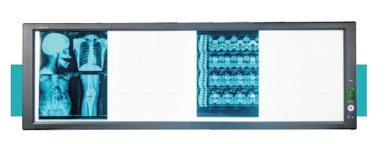 Good price Scatola luminosa LED per visione medica super luminosa in linea