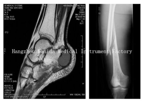 Prezzo buono Film asciutto medico di rappresentazione di protezione dell'ambiente con le stampanti termiche di Fuji/AGFA in linea