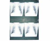 Film medico basso bianco della carta di X Ray a prova d'umidità per la stampante a laser di Sony/EPSON