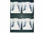 Film medico basso bianco della carta di X Ray a prova d'umidità per la stampante a laser di Sony/EPSON