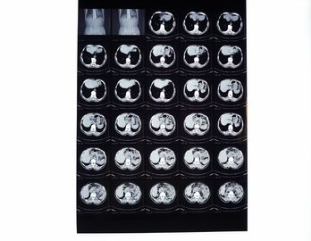 Film asciutto 2000 di X Ray di Drypix 8 x Scrach a 10 pollici resistente per Fuji 3000