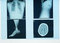 Rappresentazione diagnostica durevole di X Ray, lastra radioscopica medica del blu del laser della carta di 43cm x di 32cm