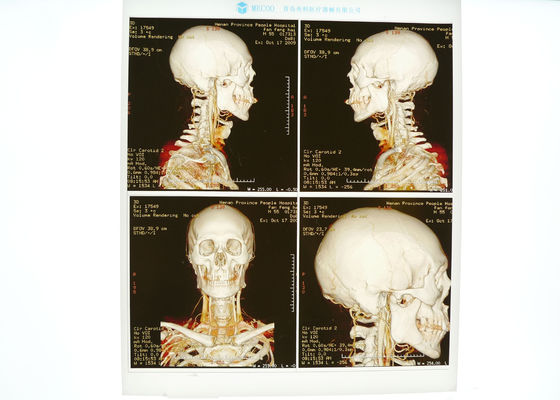 Prezzo buono Blu medico ad alta densità della lastra radioscopica per la stampante a laser di Konida in linea