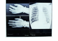 Termale asciutto medico del film di X Ray di Konida per AGFA 5300/Fuji 3000