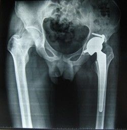 Prezzo buono Film asciutto medico 28cm * 35cm di rappresentazione di Konida del supporto in poliestere bluastro basso della nebbia per la stampante termica in linea