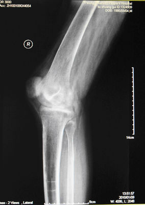 Prezzo buono Film asciutto medico KND-A di rappresentazione di alta acutezza per AGFA 5300, 5302, 5500, 5502, 3000 in linea