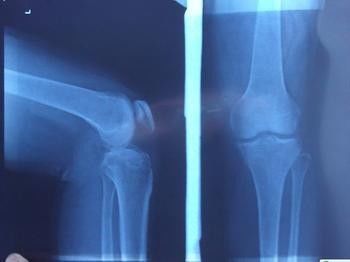 Rappresentazione diagnostica blu di X Ray, pellicola fotografica medica dei raggi x della carta del laser