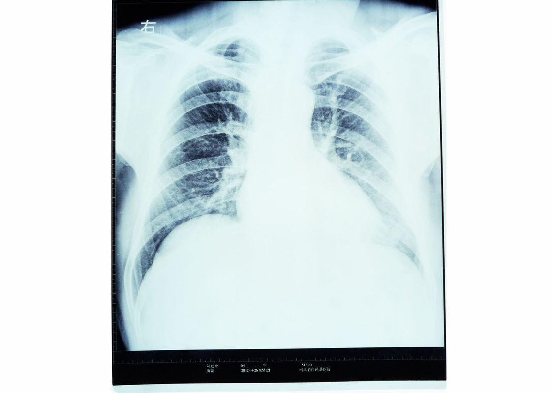 Radiologia diagnostica medica asciutta di rappresentazione di X Ray per AGFA/FUJI 2000