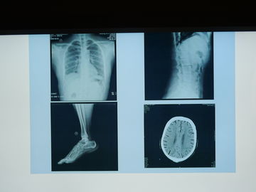 Good price Film di imaging biomedico di Konida X Ray impermeabile per la stampante di Agfa in linea