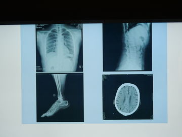 Film di imaging biomedico di Konida X Ray impermeabile per la stampante di Agfa