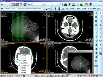 Good price 8 rappresentazione diagnostica medica del laser X Ray della carta di x 10inch per KND-DRYTEC 4000 in linea
