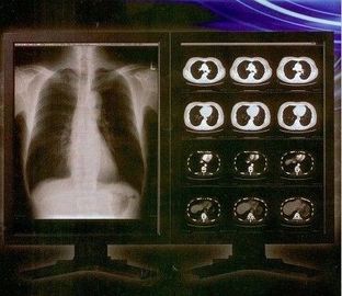 Good price Chiara lastra radioscopica luminosa di Digital, film medico della trasparenza del laser di Konida in linea