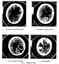 Good price A 8×10 pollici di carta medico Del film asciutto trasparente della stampante a laser X Ray in linea