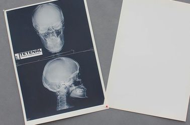 Good price Acutezza impermeabile della lastra radioscopica di carta medica bianca del petto alta in linea