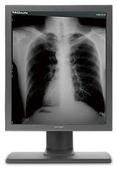 Good price 4096 esposizioni G51SP del grado medico della scala di grigi ha cinque milione pixel in linea