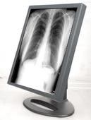 Good price Le esposizioni veloci del grado della trasmissione, grado medico visualizza G51SP in linea