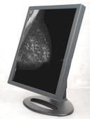 Good price Esposizioni del monitor del grado medico in linea