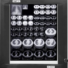 Lastre radioscopiche mediche basse bianche portabili, film della carta dei raggi x di imaging biomedico