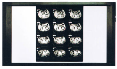 Film asciutto diagnostico del laser X Ray medico per la stampante Fuji/di AGFA