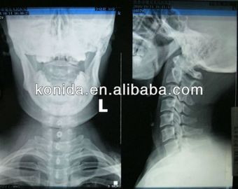 Good price Rappresentazione diagnostica medica di alta acutezza, lastra radioscopica asciutta di AGFA in linea