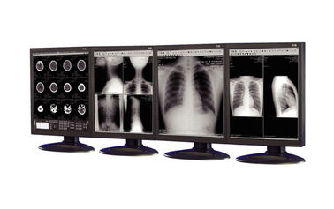 esposizioni Anti-riflettenti del grado medico utilizzate nell'attrezzatura di imaging biomedico