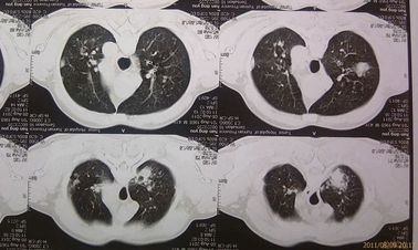 Film asciutto medico ecologico Agfa 2B X Ray con la macchina di CT