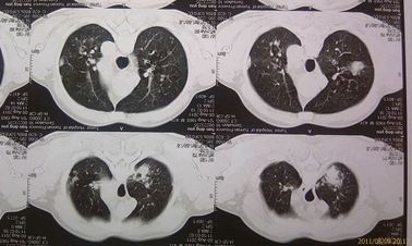 Good price Film asciutto medico ecologico Agfa 2B X Ray con la macchina di CT in linea