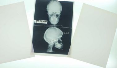Good price una rappresentazione diagnostica medica di 11 x 14 laser per la stampante a laser Di Konida in linea