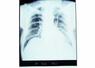Good price Film asciutto di rappresentazione di Konida, film medico di rappresentazione del laser della carta in linea