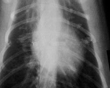 Good price Nebbie bassa 11 x lastra radioscopica di carta 14 per le stampanti a laser Mediche KND-K in linea