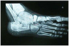 Good price carta medica di rappresentazione diagnostica degradabile di X Ray di 17in x di 13in per la stampante a laser in linea