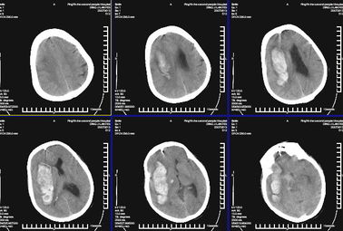 Good price Rappresentazione diagnostica medica impermeabile KND-K di X Ray per la stampante a laser di Konida in linea