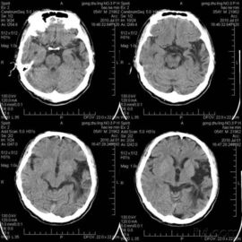 Good price imaging biomedico Graffio-resistente di X Ray per la stampante a laser di Konida in linea