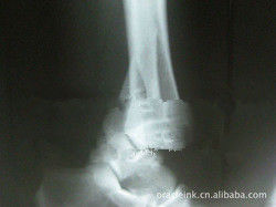Good price Imaging biomedici 8in x 10in del laser X Ray del Libro Bianco impermeabile in linea